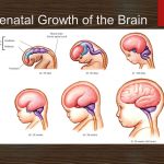 Prenatal+Growth+of+the+Brain