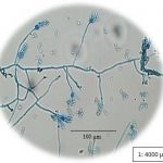 Penicillium Sp Grown On Sabouraud Dextrose Agar Medium 400 X Magnification Lactophenol