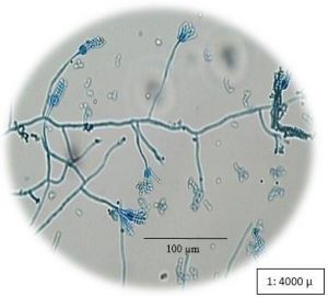 Penicillium Sp Grown On Sabouraud Dextrose Agar Medium 400 X Magnification Lactophenol